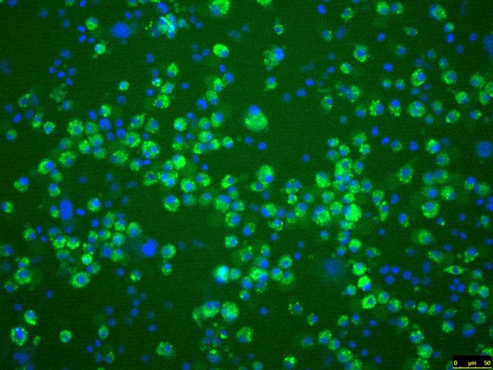 Human Endothelial Progenitor Cells (EPC) - In Adherence - With Electroporation